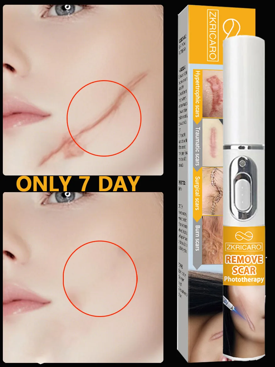 Do you want to have perfect skin?