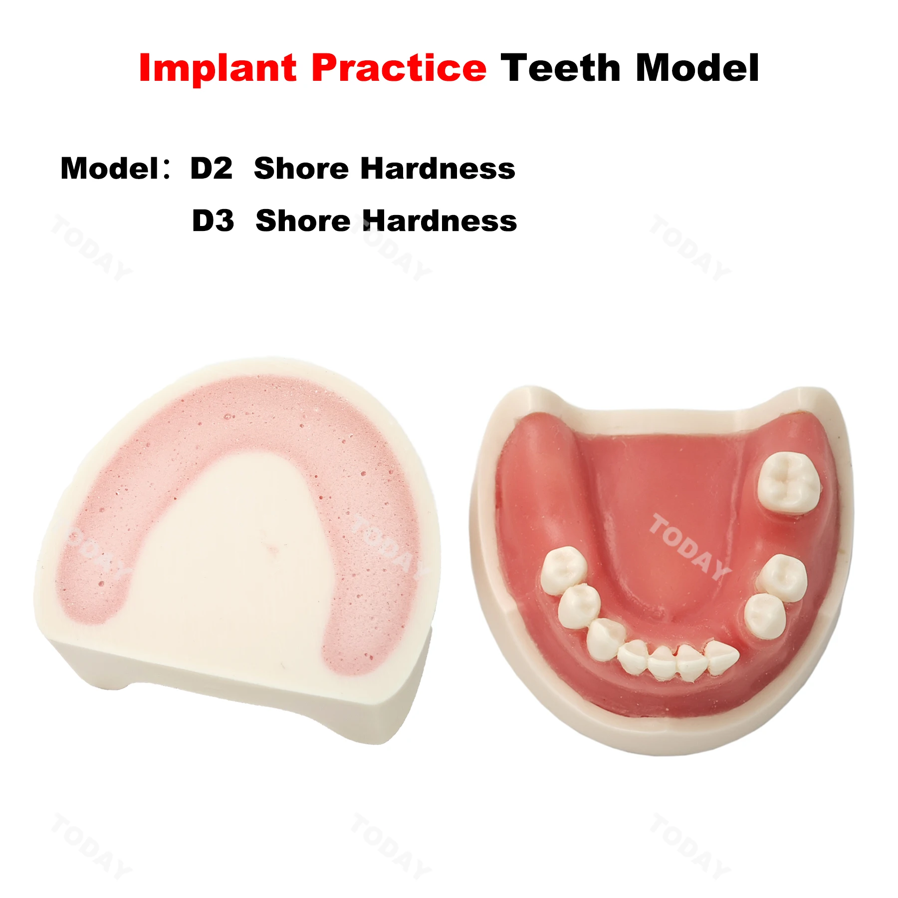 Dental Model Teeth Implant Practice Tooth Model For Dentist Student Training Practice Studying Oral Medical