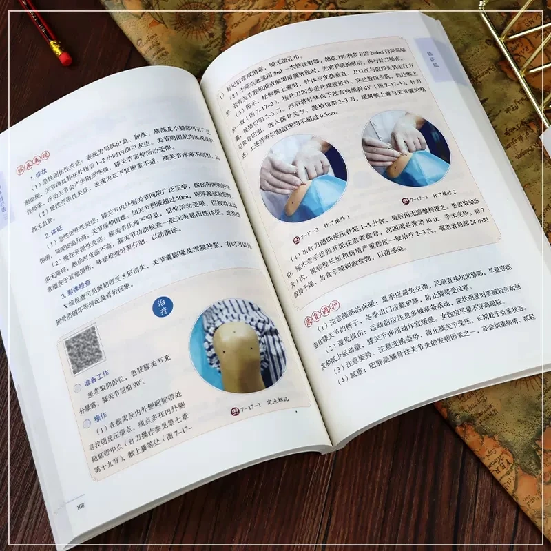 Libro gráfico de terapia con agujas y cuchillos, Serie de operación de medicina tradicional china, tecnología práctica, cuidado de la salud, nuevo