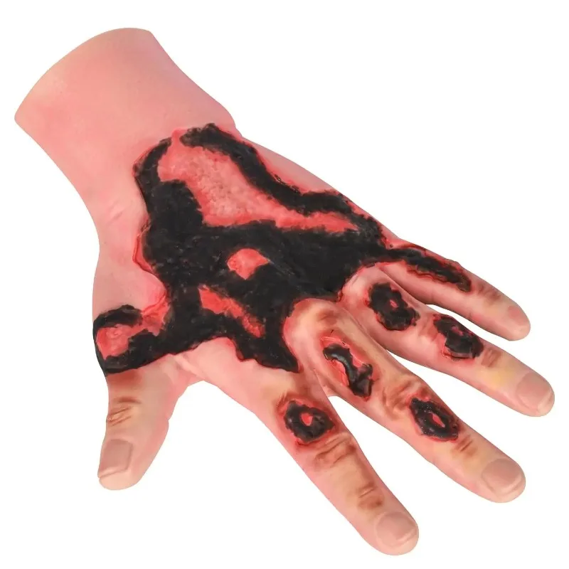 3rd Degree Forearm Burn Simulation Sleeve Simulated Burn Wound Dressing Trainer Medical Wound Care Teaching Model