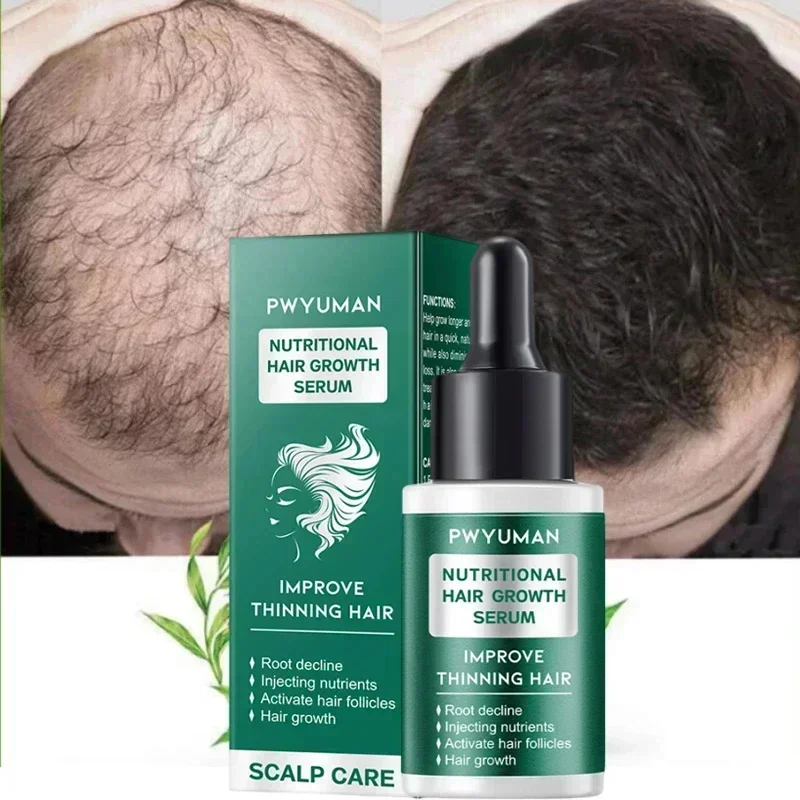 

7 Days Fast Hair Growth Serum Anti Hairs Loss Treatment Essence Scalp Baldness Nourish Hair Root Regrowth Hair For Men Women