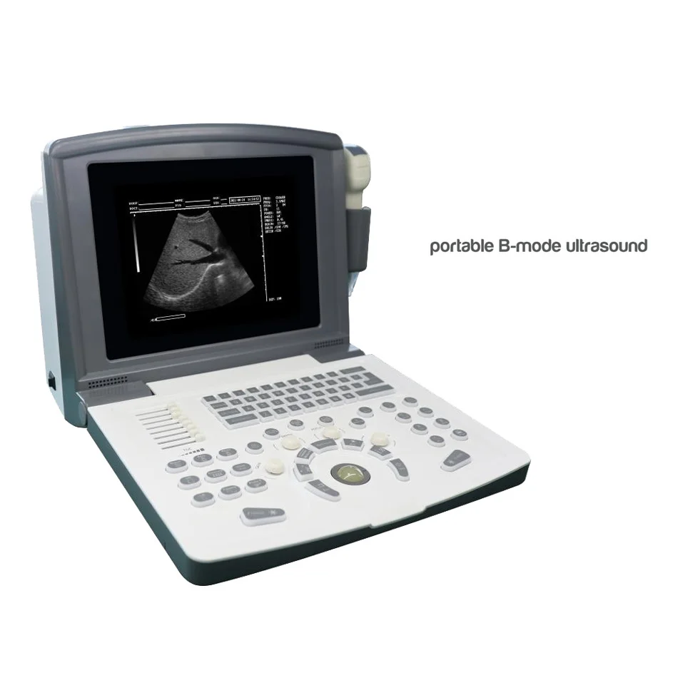 Portable Animal Ultrasound Scanner Ultrasonic Diagnostic System Doppler Machine