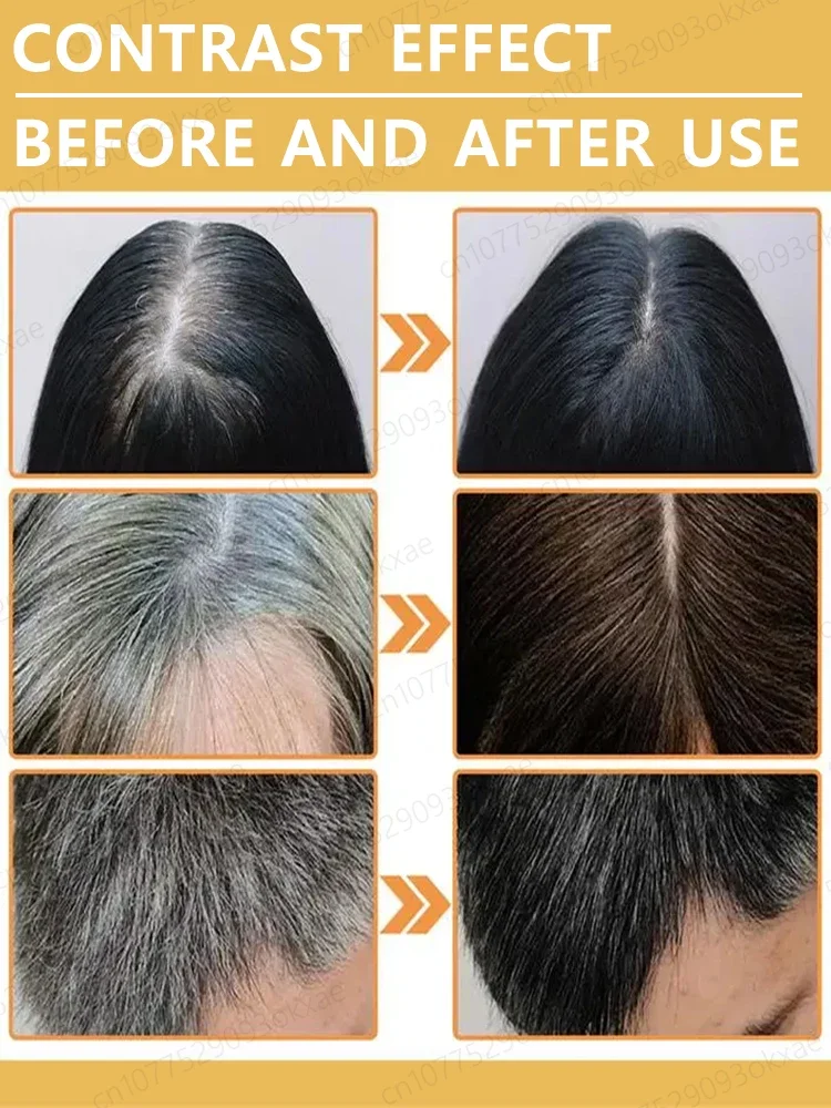 White hair killer, remove gray hair and restore natural hair color in 7 days