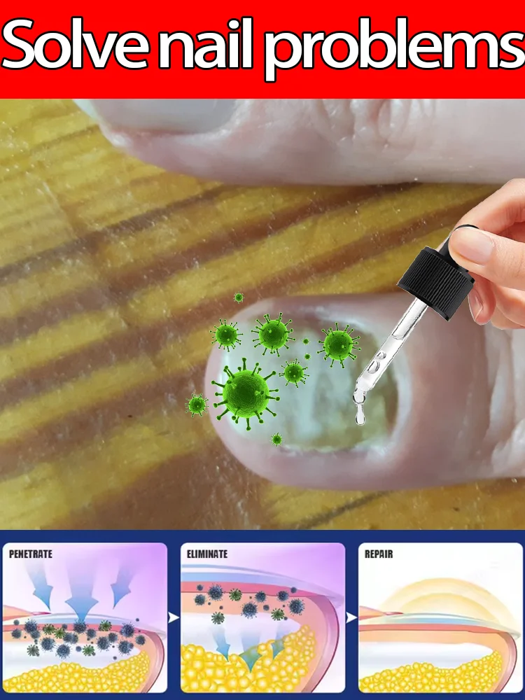 

Show your beauty again ⁿᵃⁱˡ - Wear open-toed shoes and be confident