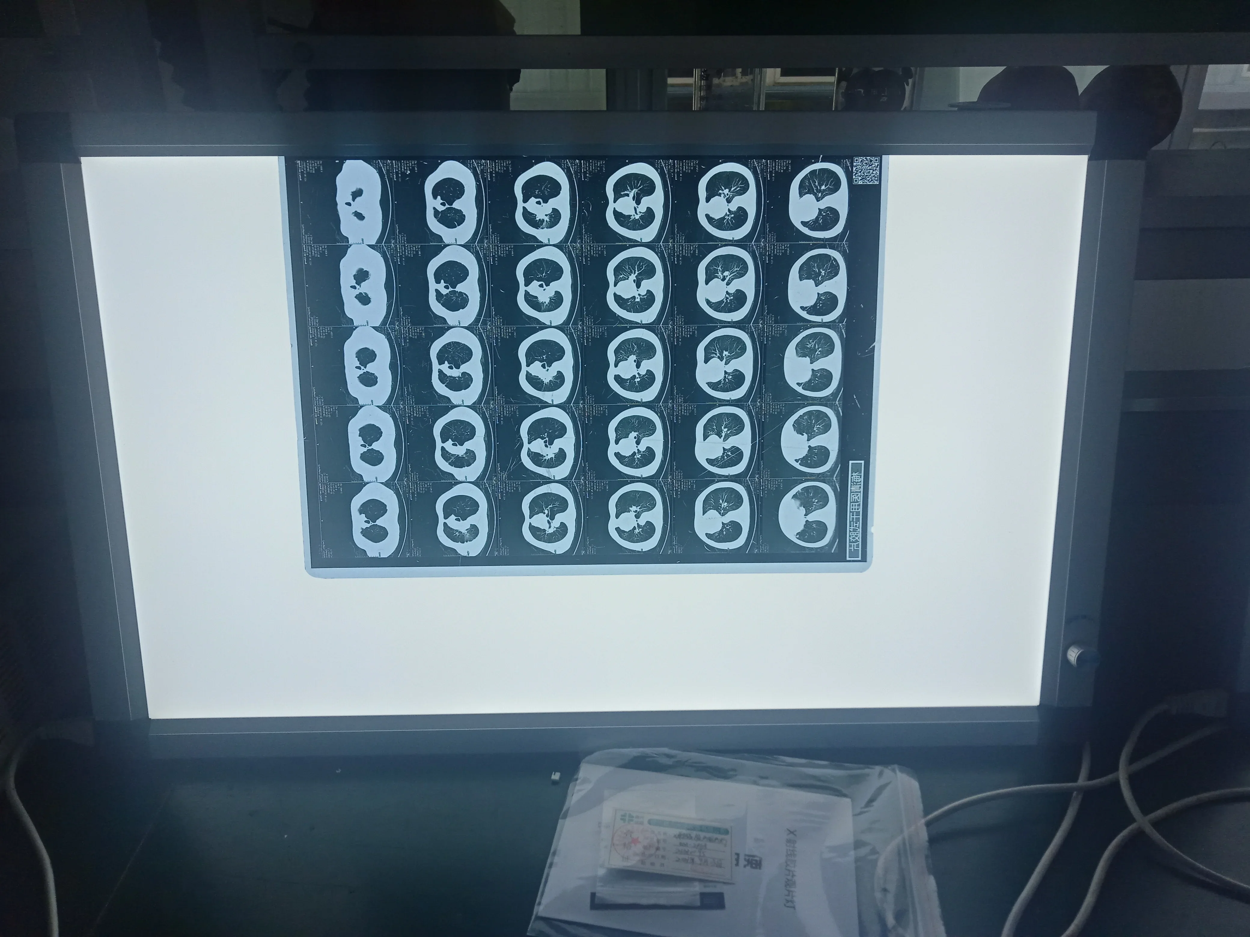 Double panel LED negatoscope X-ray Film Viewer Illuminator