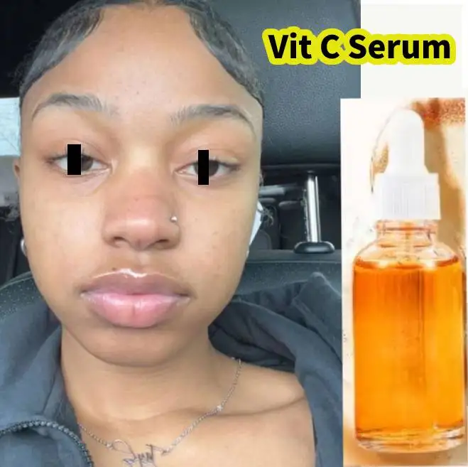 

Serum Vit C Serum Whitening Ginseng By White Perfect for Body Skin Care 30ml. Free Ship