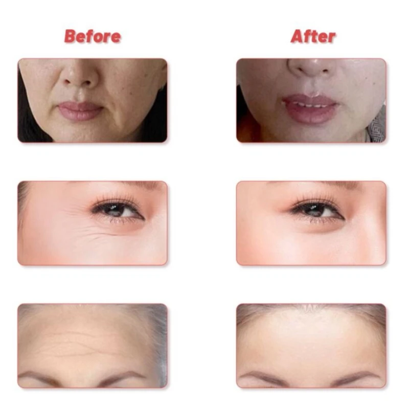 Face Massager Neck Face Eye Beauty Device Facial Lifting Bar Roller Skin Rejuvenation Anti Aging Wrinkles Tightening Skin Care