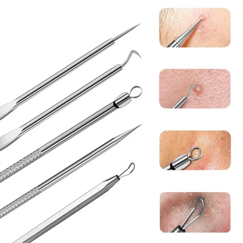 Duits Ultrafijn nr. 5-cel puistjes mee-eter clip pincet schoonheid gezicht gezondheid salon speciale mee-eter verwijderaar acne naald tool