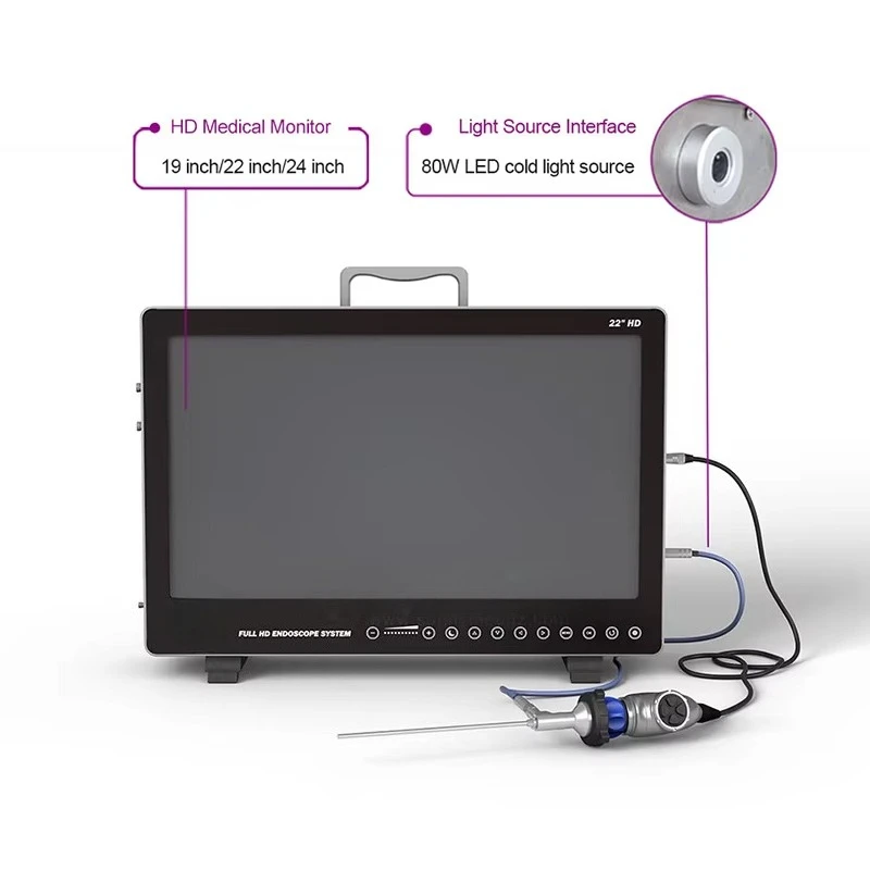 SY-PS050 new high definition CMOS veterinary integrated endoscope system