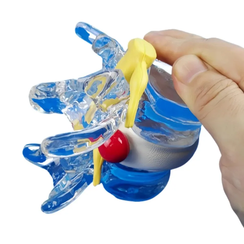 Spine and spinal cord extrusion demonstration model Human medical teaching model Spinal cord bubble ball