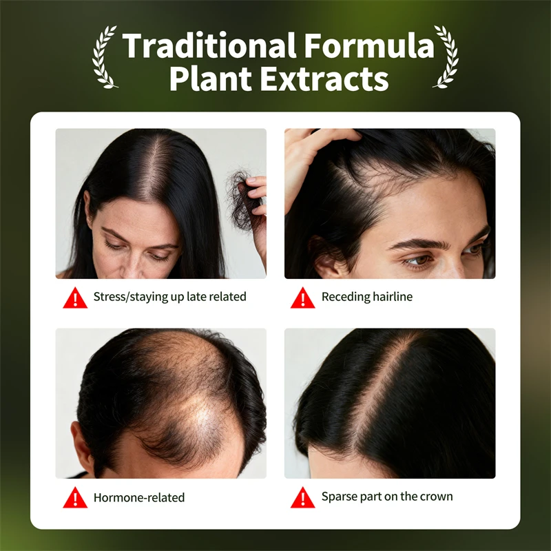 Thumbnail 2 - #49 Latest Hair Loss Treatments Updates