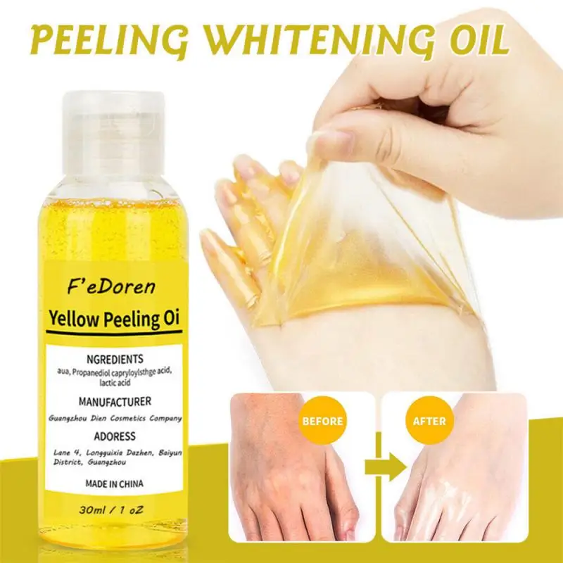 Yellow Peeling Oil Exfoliating Deep Cleaning Section Exfoliating Remove Dead Skin Smooth Melanin Even Bright Body Skin Care New