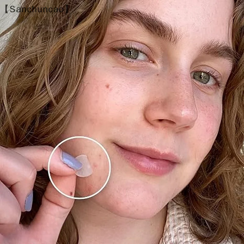360개 라운드 투명 여드름 패치 스킨케어 스티커 메이크업 도구