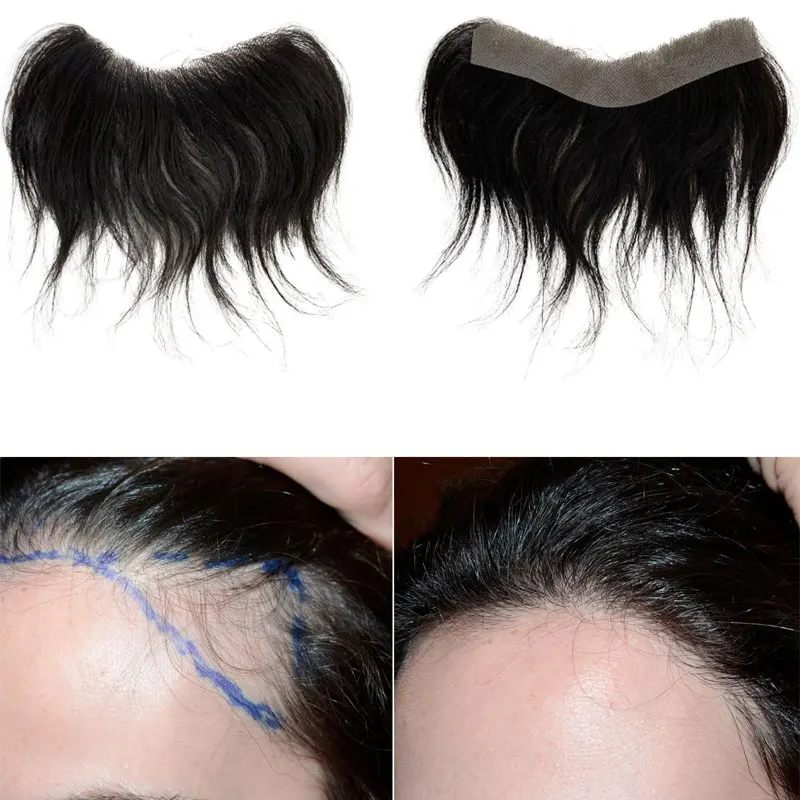 Frontal Hairpiece For Women Human Hair Extensions Forehead Hairline PU Skin Toppers Hair Replacement Toupee For Men