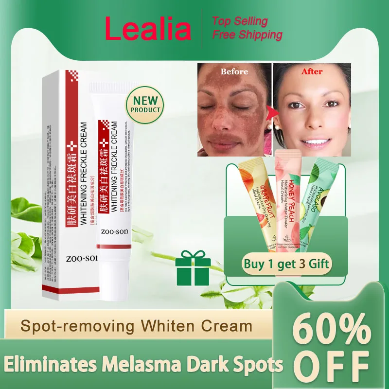 Powerful Spot-removing Whiten Cream Brighten Skin Fast Eliminates Melanin Pigmentation Melasma Dark Spots Korean Skin Care