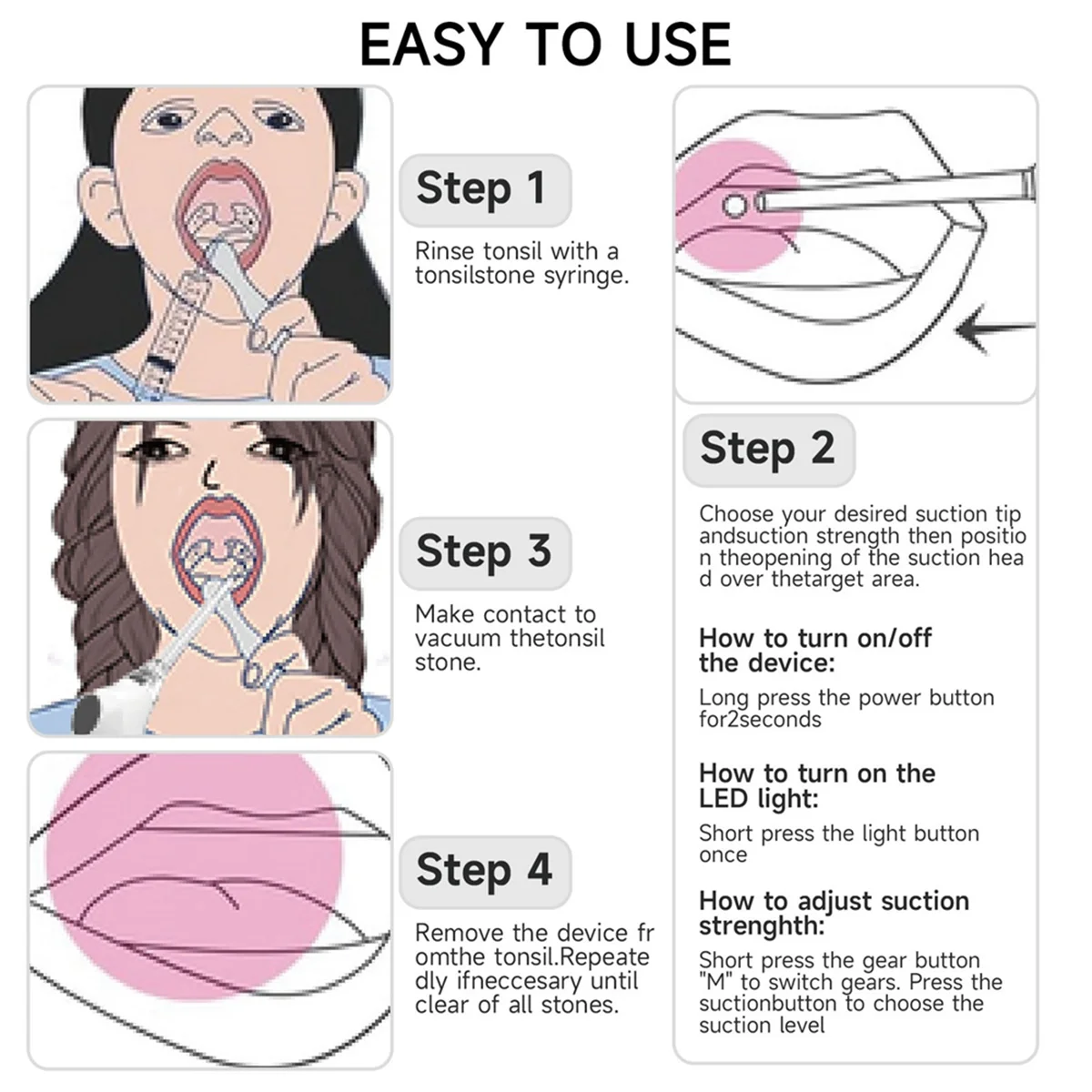 مجموعة إزالة حجر اللوزات الإلكترونية BVBV، مكنسة إزالة حجر اللوزات، منظف الفم الأوتوماتيكي للعناية بالفم، منظف اللوزات