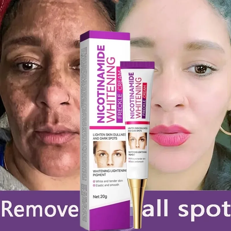 

Deep To Prevent Melanin Pigment Precipitation Face Cream Fade Dark Skin Lotion Bleaching Effective Lightens Black Skin Cream