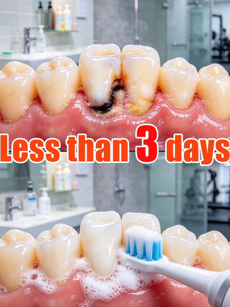 Зубная паста от кариеса，High-tech toothpaste that can repair cavities