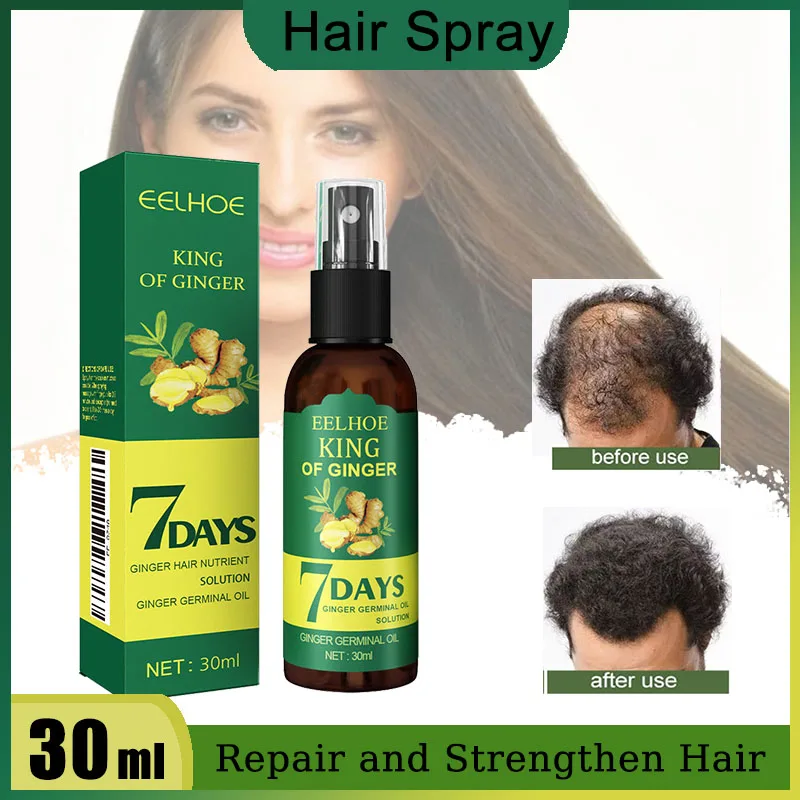 

(30 мл в штучной упаковке) Ginger Care Спрей для волос Эссенция для роста Питает корни волос Массаж для восстановления кожи головы Контрольное масло Раствор для ухода за волосами Мягкий