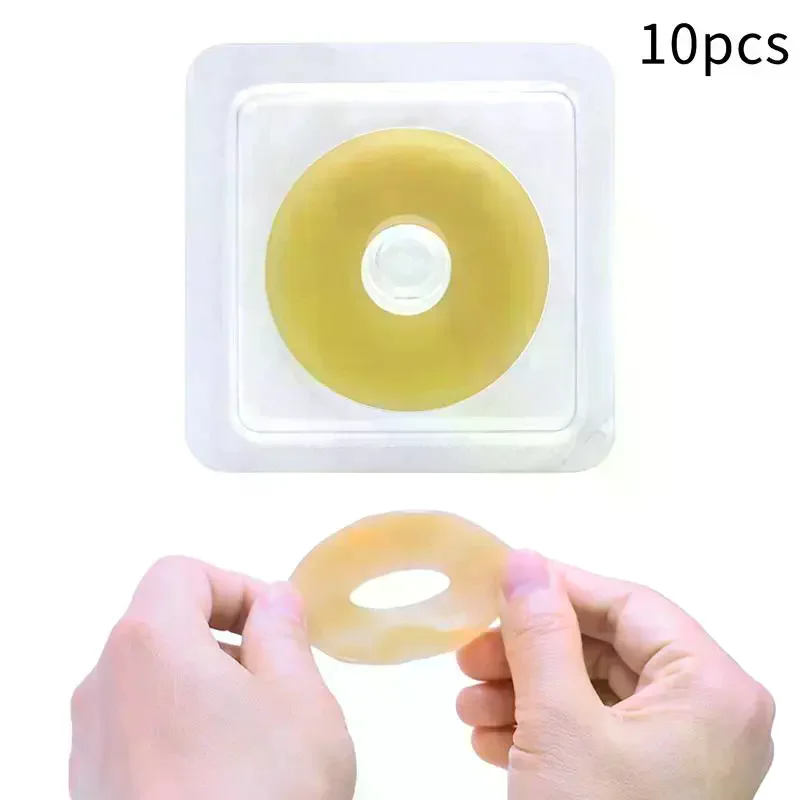 10Pcs Anti-Leakage Ring For Colostomy Bag Ostomy Paste Ring Baseplates Stoma Care Products To Protect Skin
