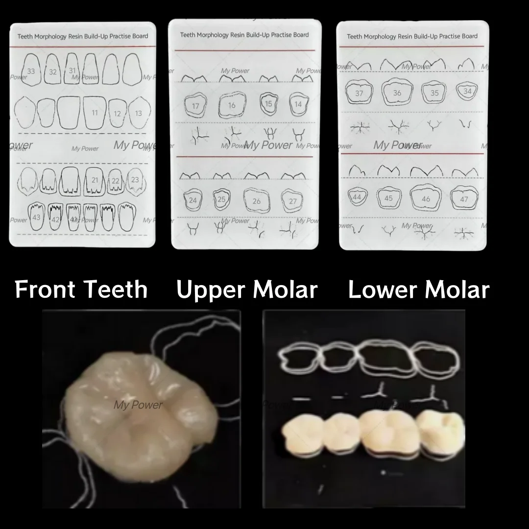 Template pengisi Resin komposit gigi, Model dokter gigi isi hitam/putih