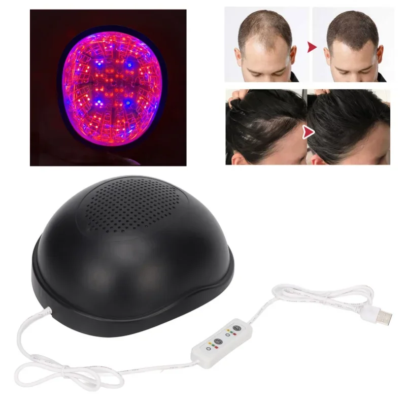 Laser Hair Growth Helmet Anti Hair Loss Treatment Hair Regrow Laser Hat Laser Cap RED (Blue) LED 62/66pcs Lamp Chips Scalp Care