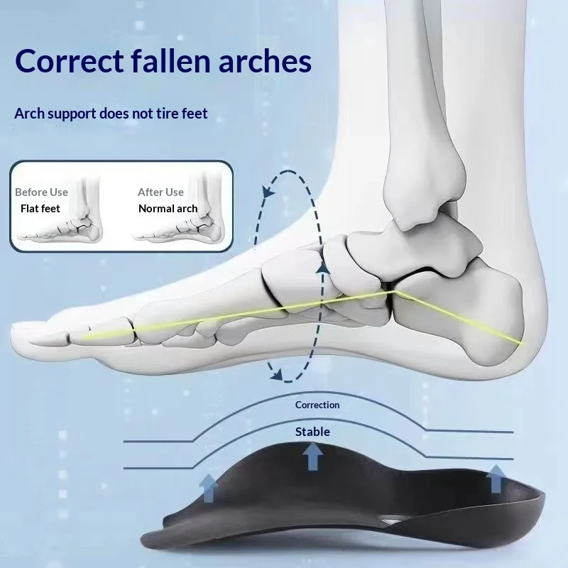 Adult Flat Foot Arch Support Insoles Correct Over‑Pronation Supination Prevent O‑Leg X‑Leg Comfort Orthotic Foot Arch Cushion