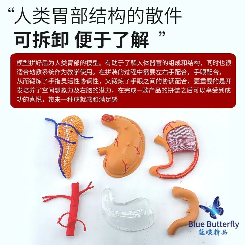 Pathological Stomach Model Pathological Stomach Model Gastroenterology Coronary Section Anatomic Enlargement