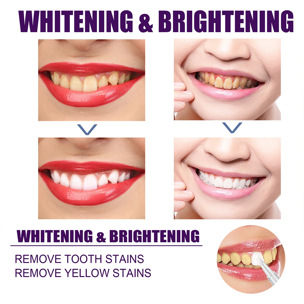 Laser Therapy For Teeth Whitening Pen Toothpastes Serum Remove Plaque Stains Oral Hygiene Cleaning Dental Bleaching Fresh Breath