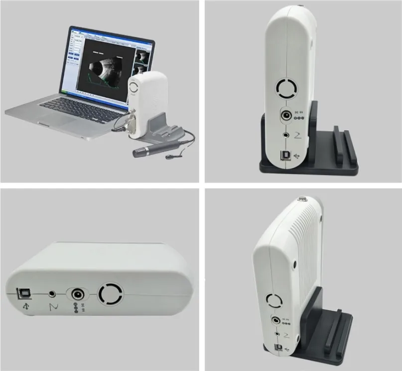 Holyavision Portable Ophthalmic  Instrument Eye test Ultrasound AB Scan