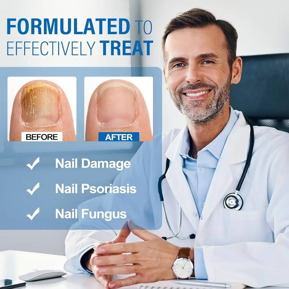7 أيام علاجات فطريات الأظافر مصل سائل مضاد للعدوى فطار الداحس العناية باليدين الأظافر جل إزالة فطريات القدم #4