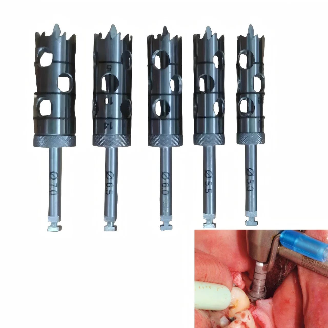 Premium Dental Trephine Drill Bit Set Stainless Steel Bone Core Harvesting Bur for Implant Surgery and Autogenous Bone Grafting