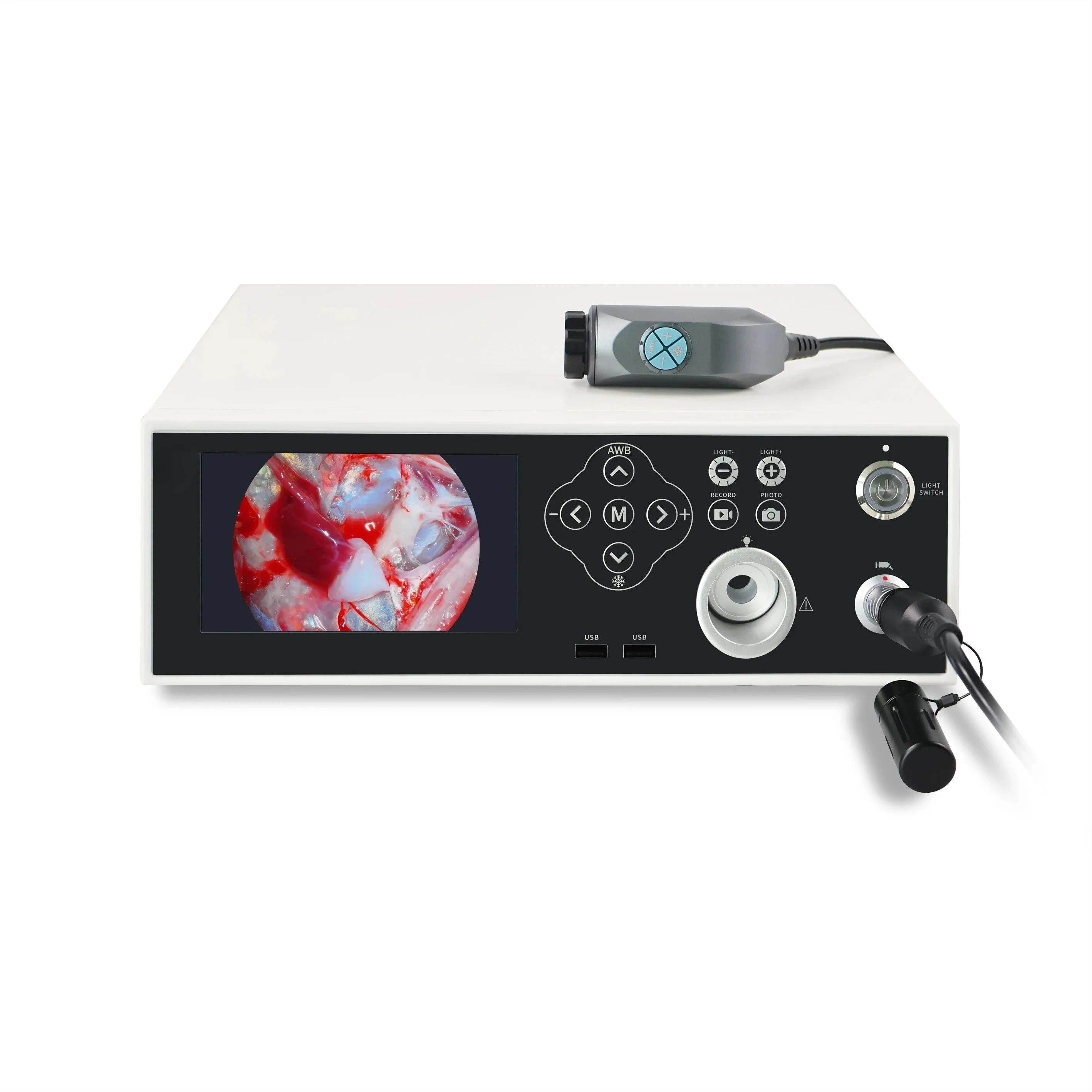 peiqi1080p Endoscopy Integrated Camera System with Optic Light Source for ENT Urology Laparoscopy Surgery