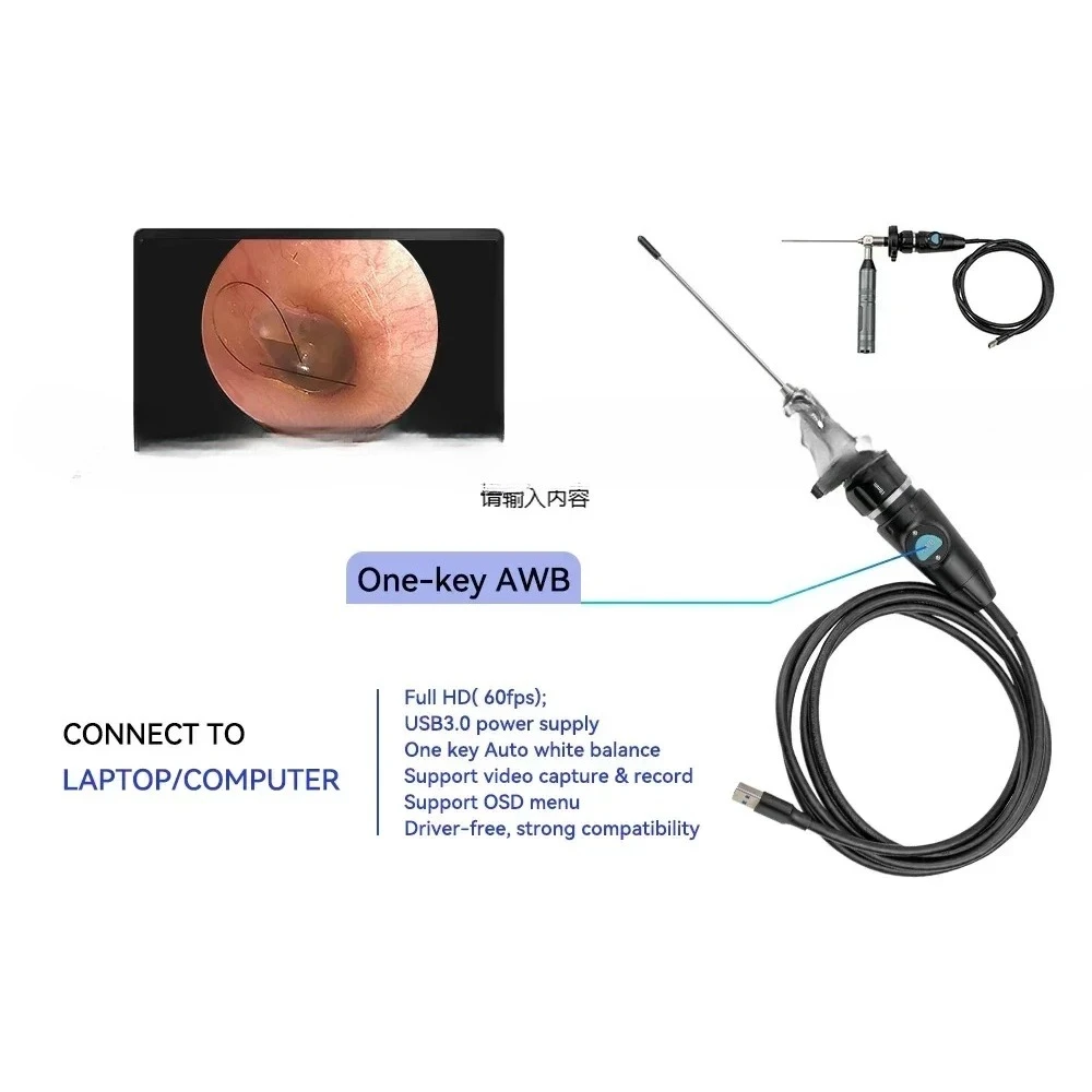 Ear Pick Pet Ent De…