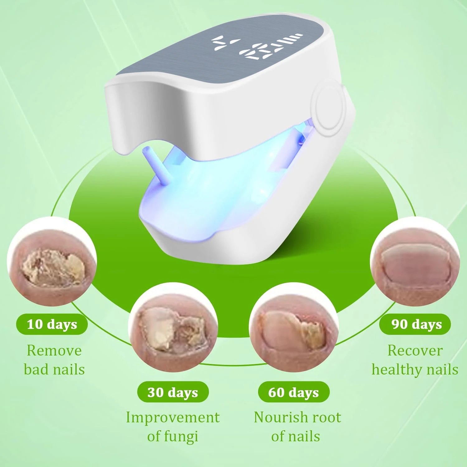 Nail Fungus Laser Assist Tool UV Professional Nail Fungus Cleaning Laser Device Nail Phototherapy Lamp Type-C Charging Wholesal