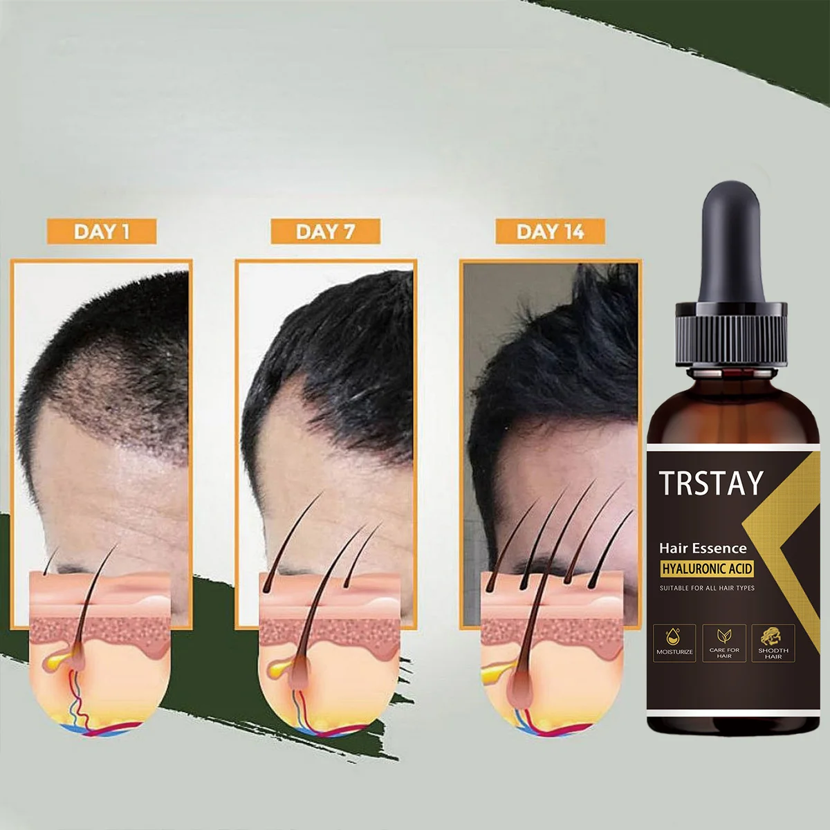 إعادة نمو الشعر الزيوت الأساسية جوهر للرجل امرأة