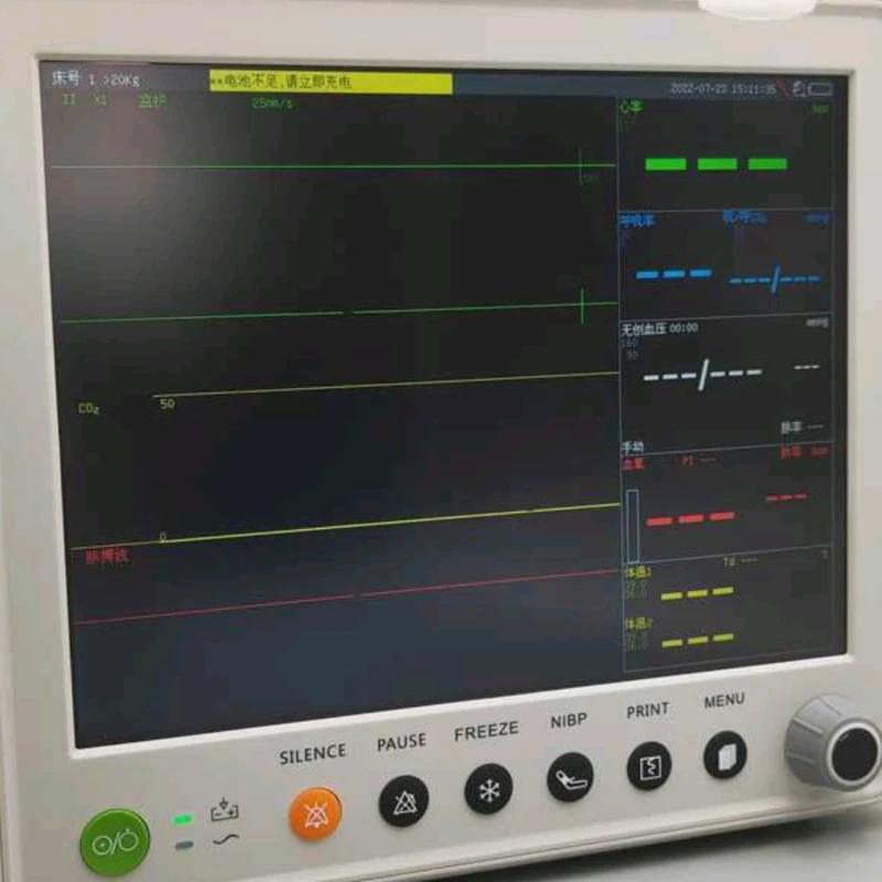 Veterinary Monitor, Pet Hospital Animal Surgery Five-parameter Monitor PM8000V UN8000EV