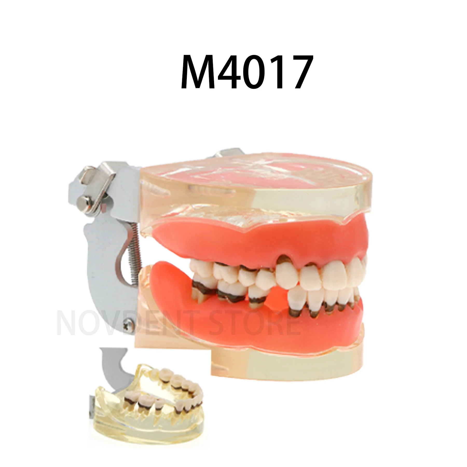 

Dental Teeth Model Removable Adult Periodontal Disease Pathological Teeth Patient Education Demo M4017