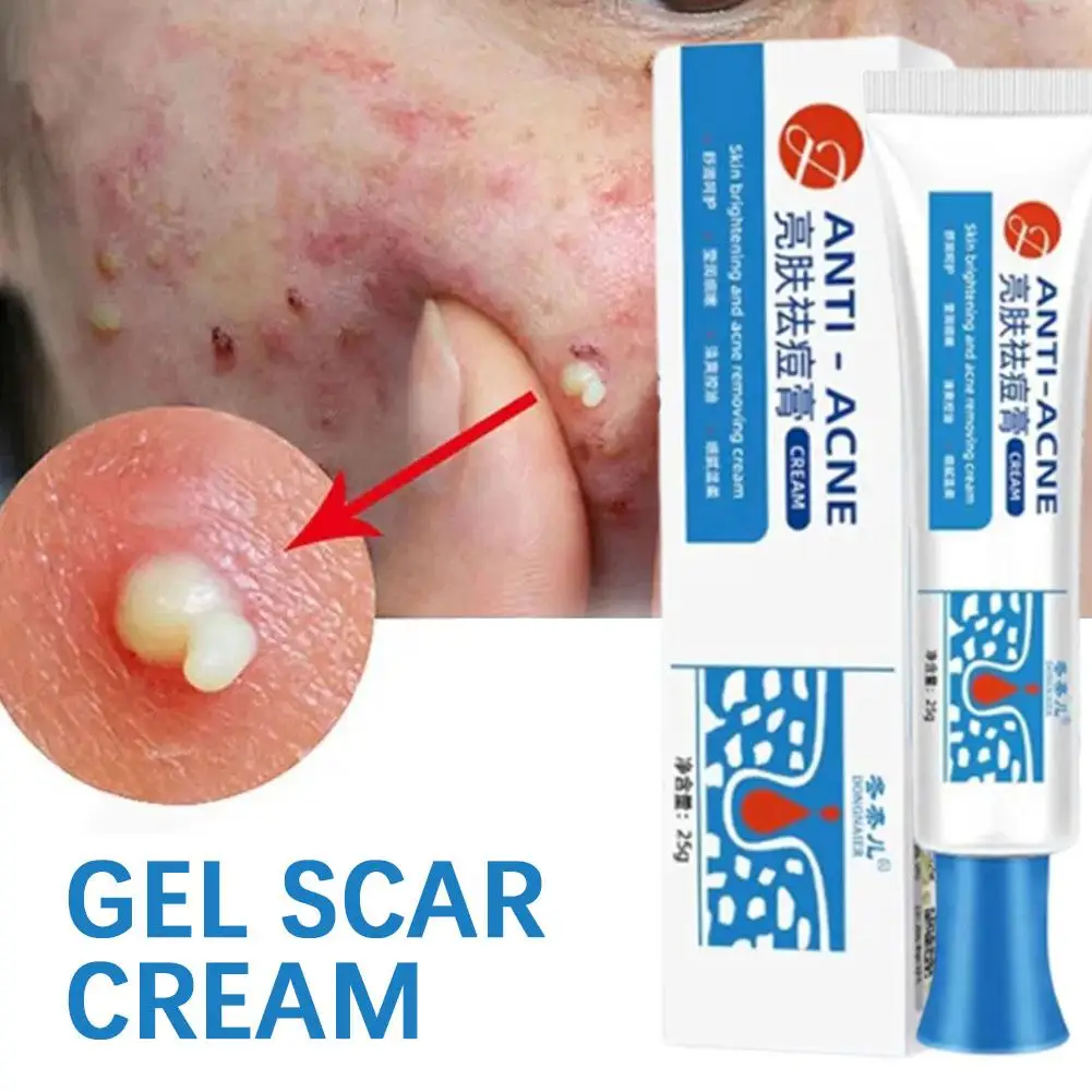 Salicylic Acid Acne Treatment Cream Repair Pimple Spots Skin Oil Deep Shrink Pore Control Cleaning Anti-acne Moisturizer Care