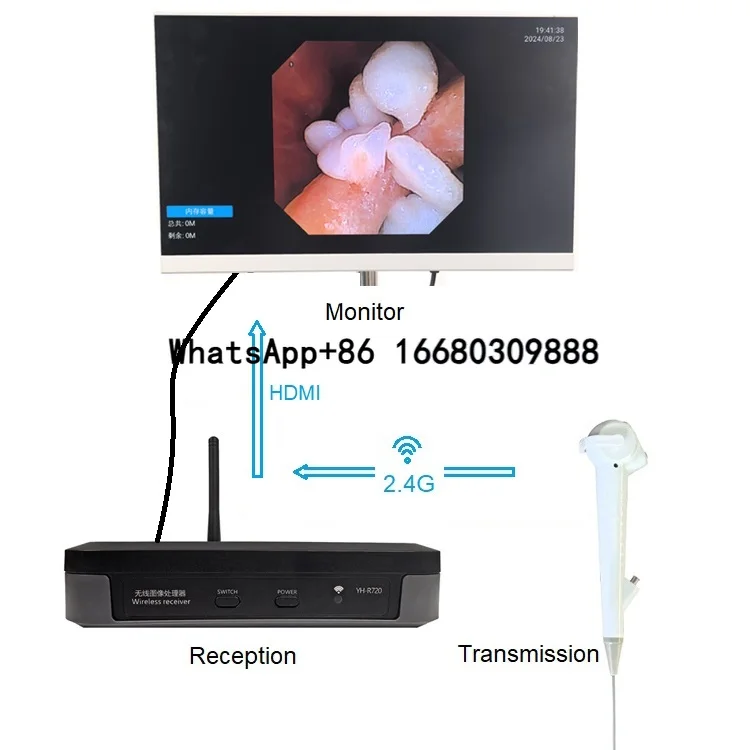 

High Quality Cheap Price Pet Medical Imaging System Animal Bron URO Cystoscope WIFI Receiver Box