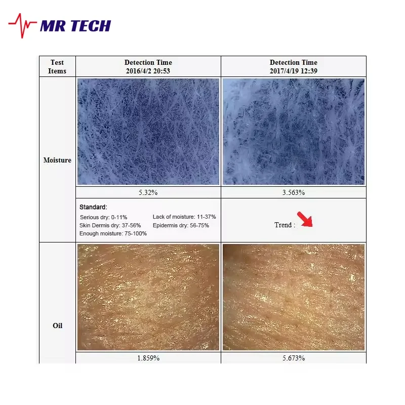 Multi Languages Professional Intelligent Skin Diagnosis Facial Analyzer 3D Skin Microscope Detector For Windows System