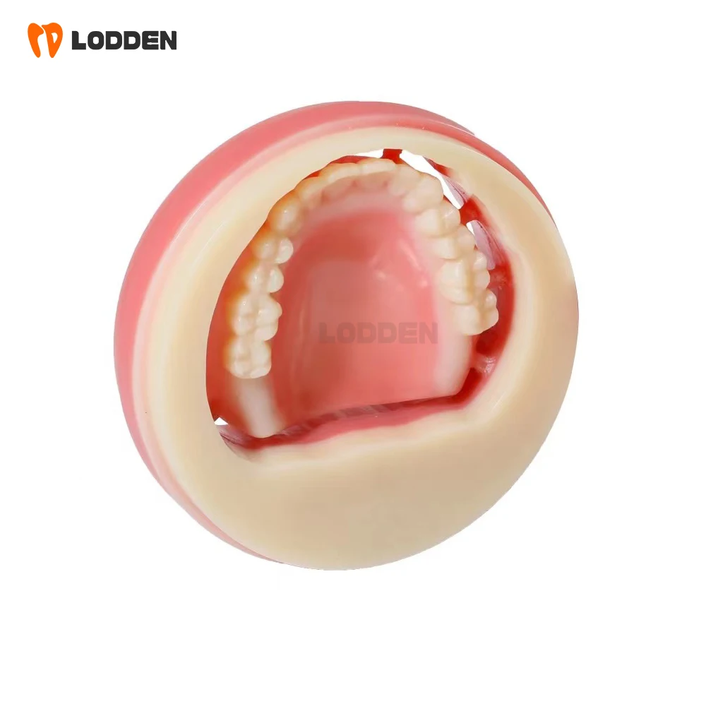 

Lodden Double Layer Dental PMMA Blocks Pink A1 A2 A3 98mm Cad Cam Dental Lab Full Denture Material for Denture and Crowns