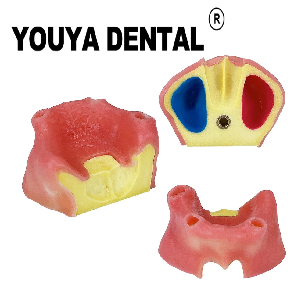 

Dentistry Edentulous Maxillary Sinus with Soft Gums Implant Teaching Model for Dentist Student Practice Training Studying Model