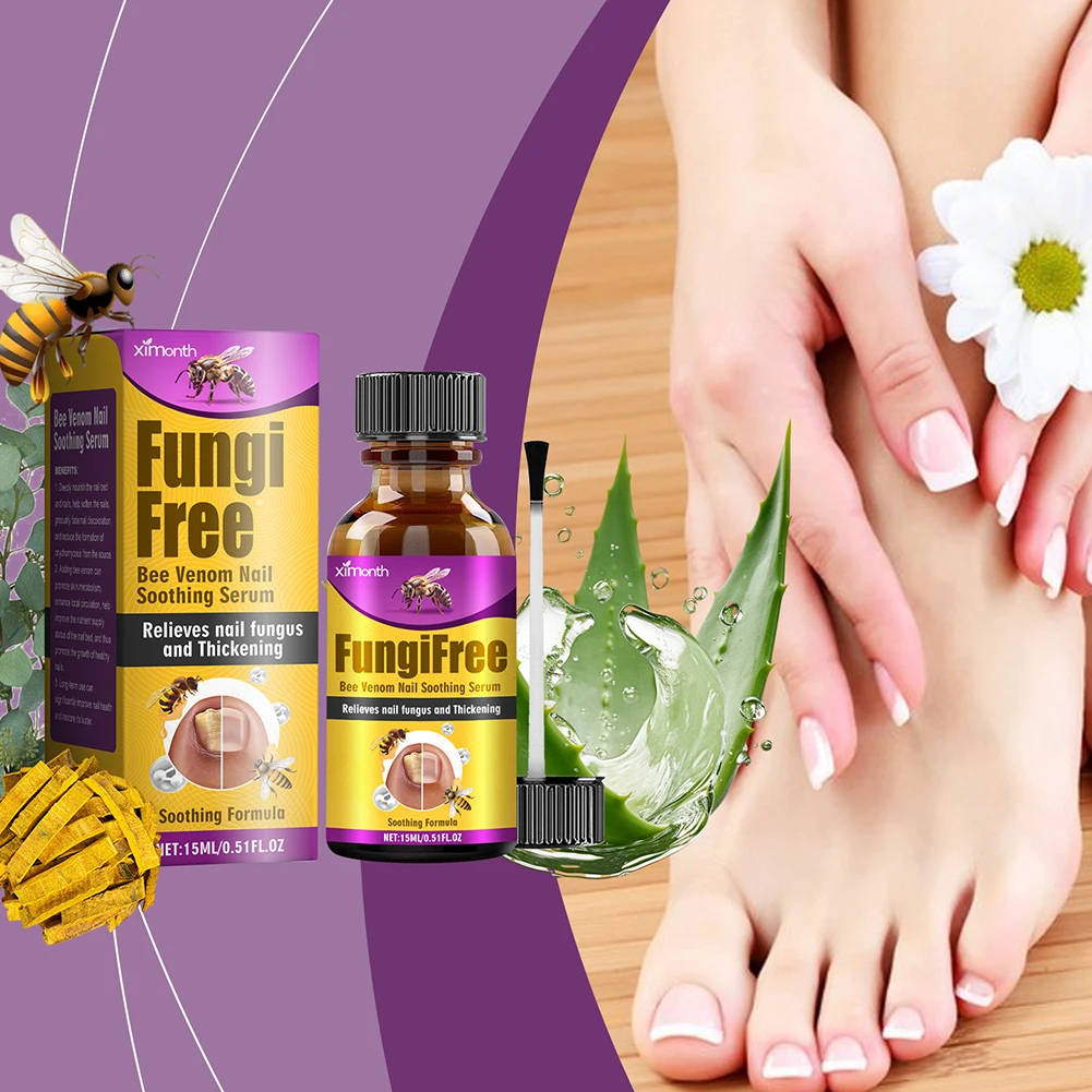 Nails Onychomycosis Treatments Liquid Natural Plant Formulas Nail Care Liquid For Broken Nails Nourishing