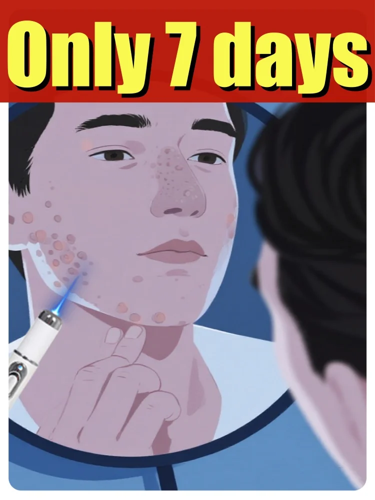 

Wart technology pen, blue light therapy, full-body care