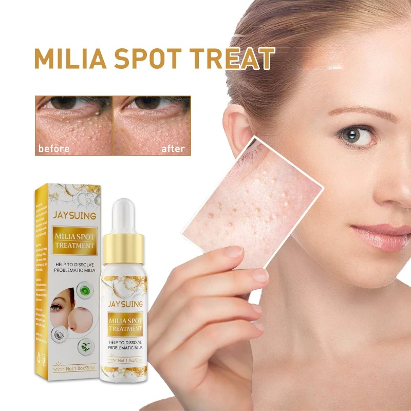 

Milia Remover Serum Anti Dark Circles Fat Granules Removal Eye Bags Brighten Skin Care Anti-Puffiness Firming Beauty Cosmetics