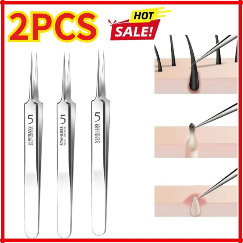

3PCS Easy-To-Use Stainless Steel Acne Extractor Set - Hypoallergenic Beauty Tweezers For Clear Skin, Perfect For Beginners