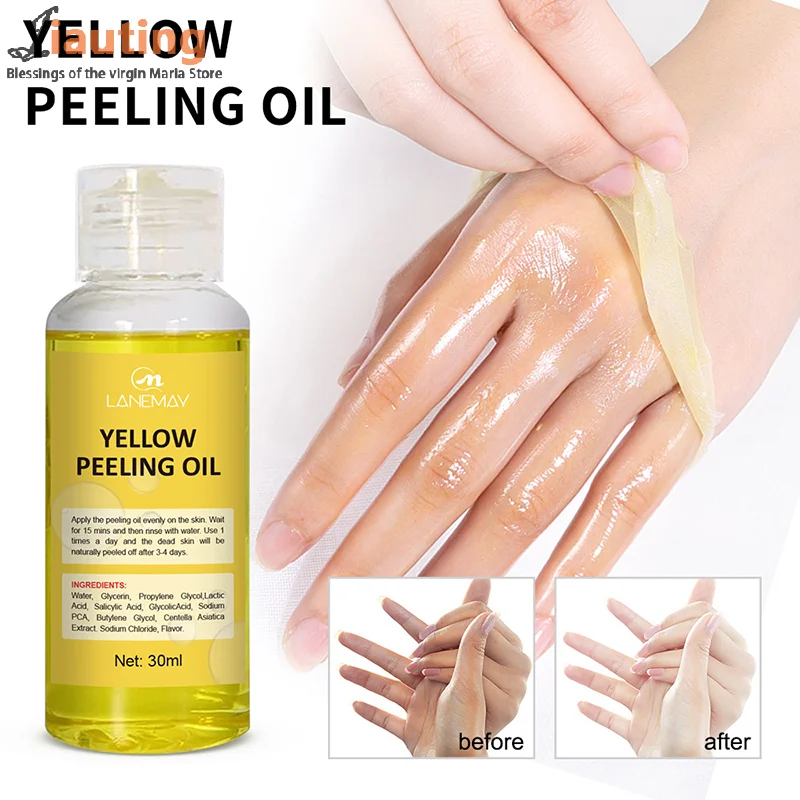

30/100ml Skin Peeling Oil Super Strength Body Peeling Oil Brightening Skin Tone Moisturizing Skin Care Exfoliating Yellow Oil
