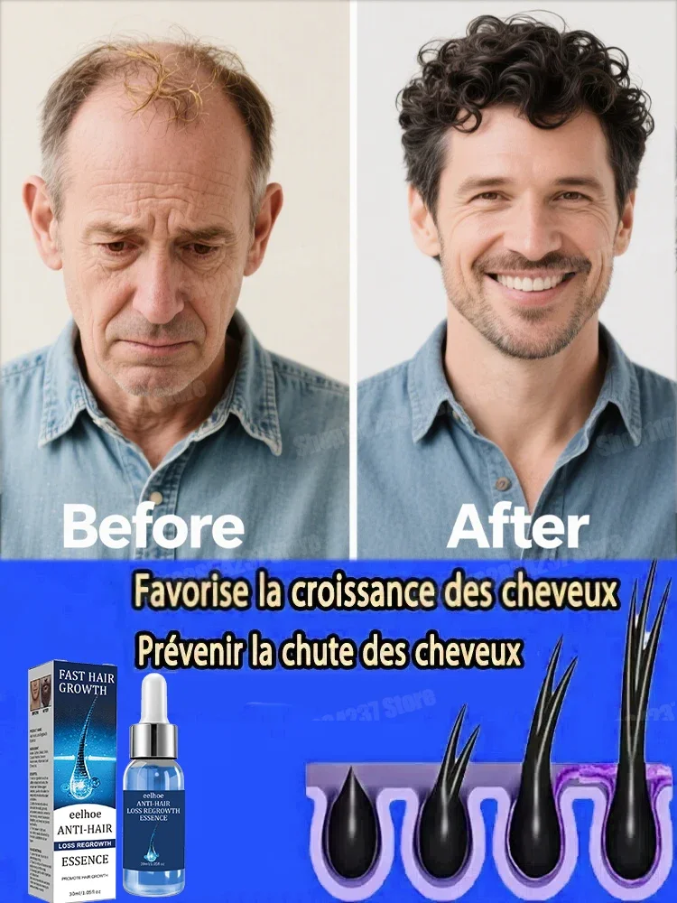 

Fast Hair Growth Oil Effective Baldness Repair Hereditary Hair Loss Postpartum Seborrheic Hair Anti Loss