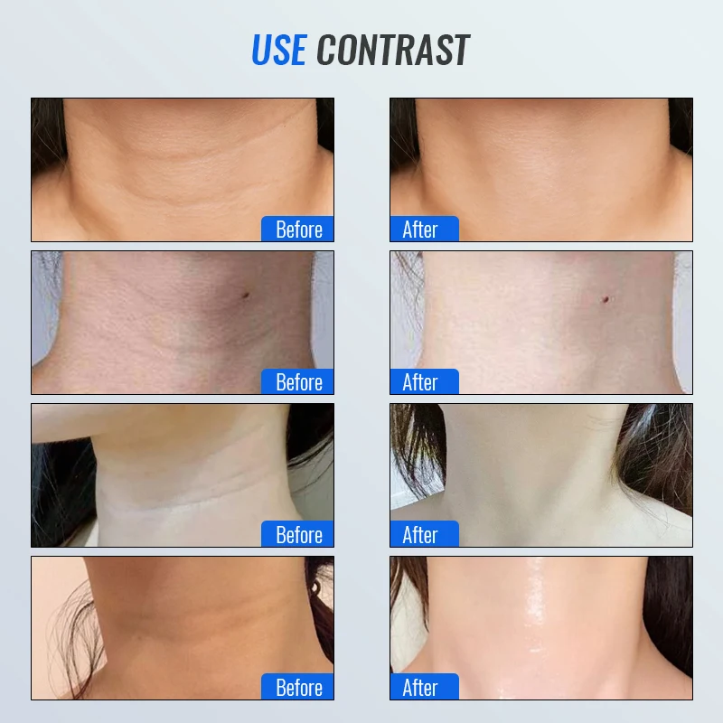LESEN Neck Face Beauty Device EMS Facial Neck Lifting 3 Colors Light Skincare Skin Tighten Reduce Double Chin Skin Care Tools